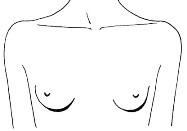 Форма груди клюковки