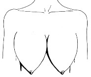 форма груди дыни